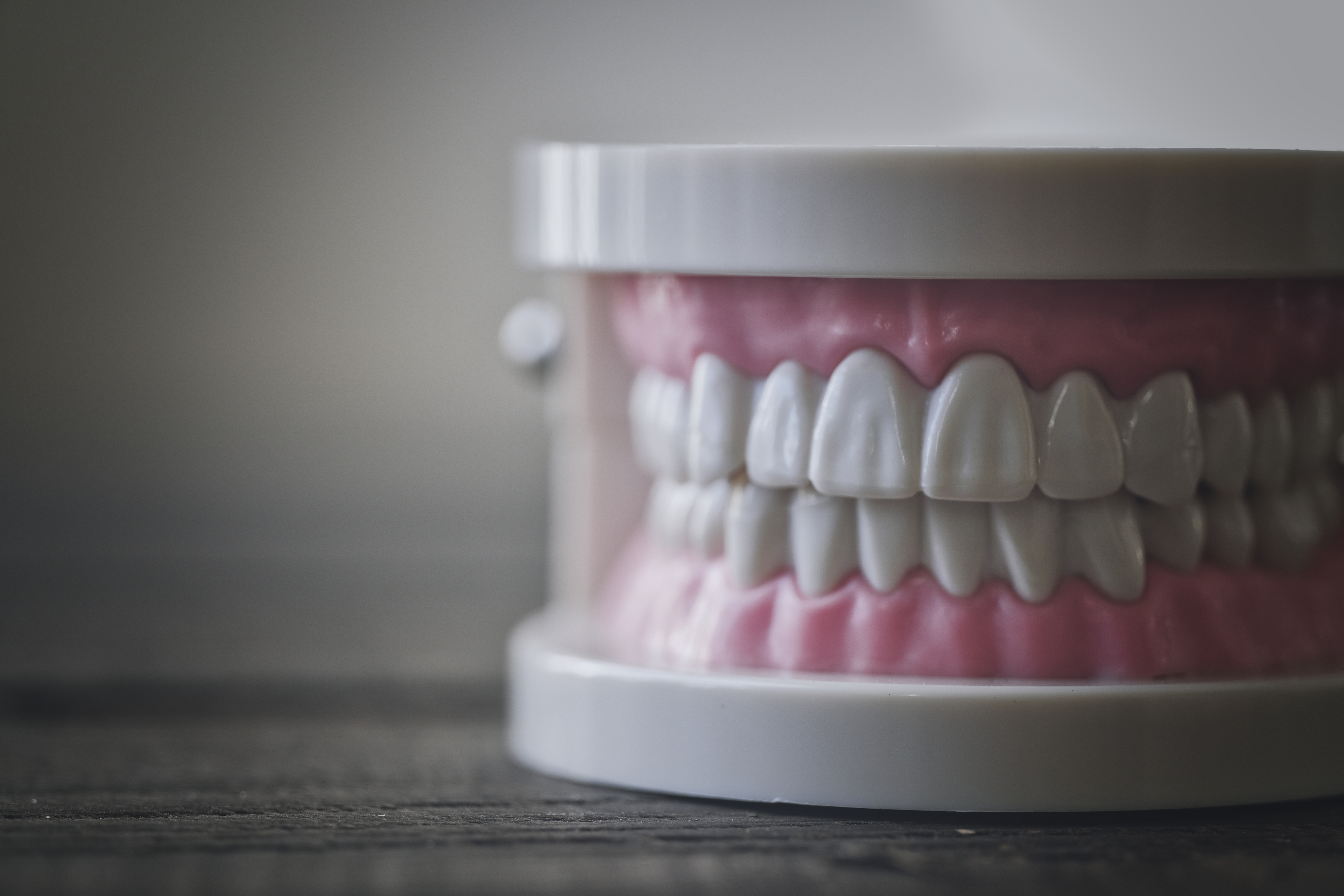 歯の色が変わった